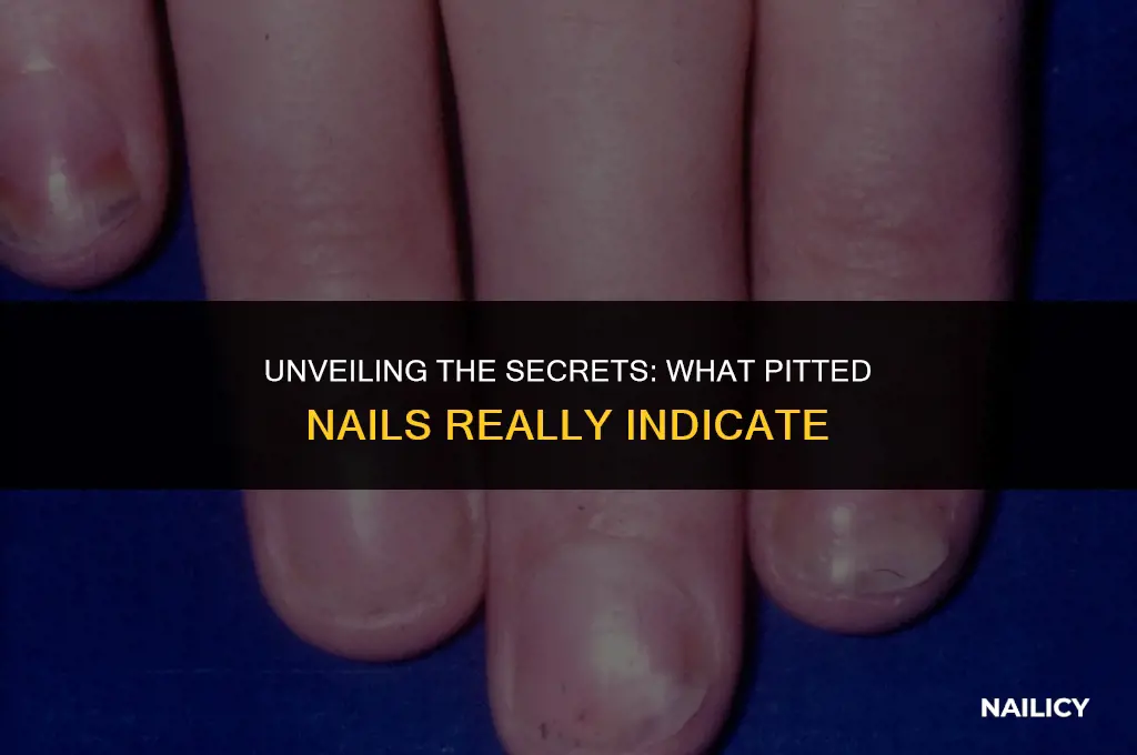 what does pitted nails indicate