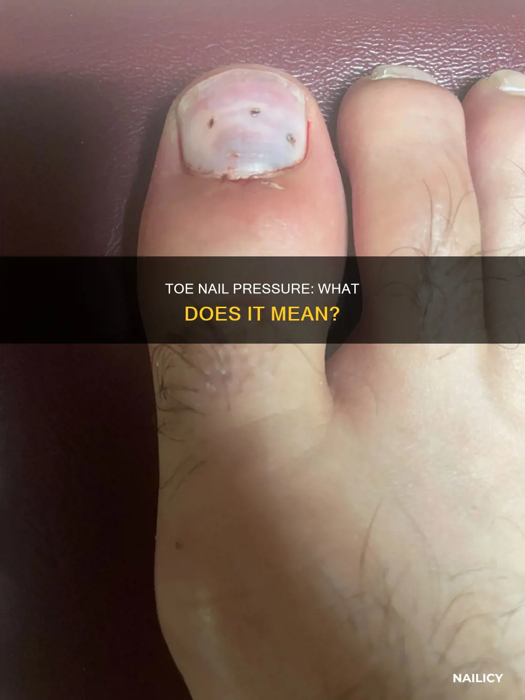 what does pressure under a toe nail mean