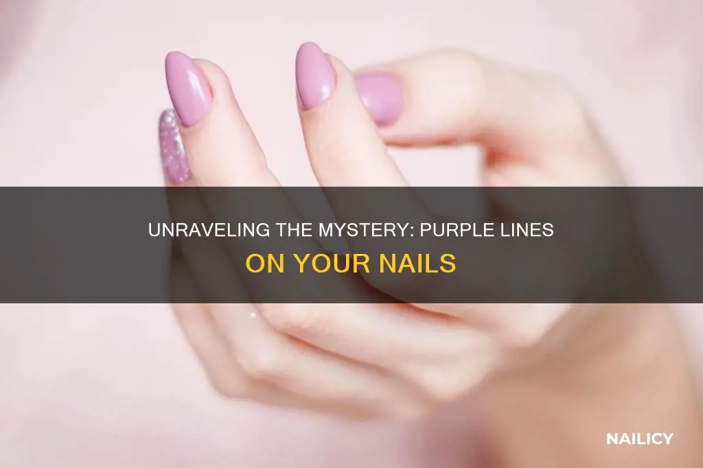 what does purple lines on nails mean