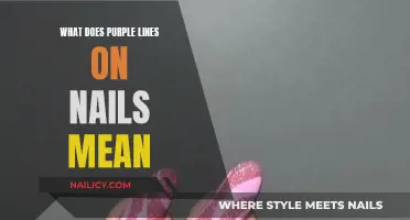 Purple Lines on Nails: What Do They Indicate?