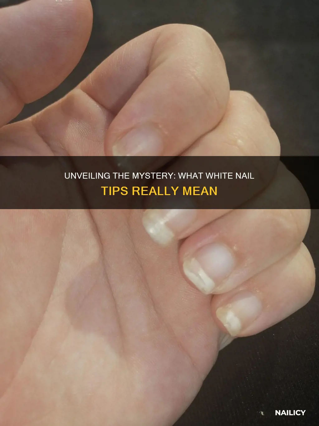 what does really white nail tips mean