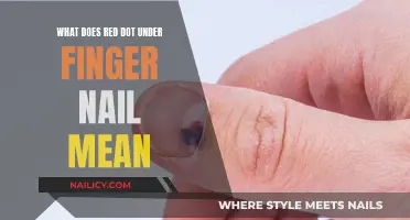 Unraveling the Mystery: Red Dot Under Nail - What's the Cause?