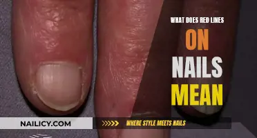 Unraveling the Mystery: Red Lines on Your Nails