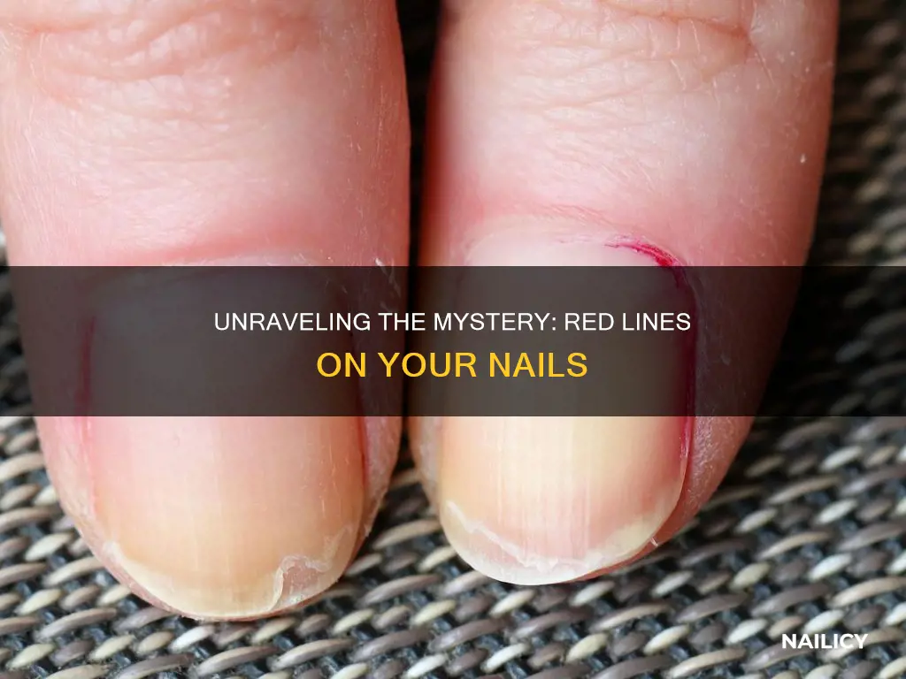 what does red lines on nails mean