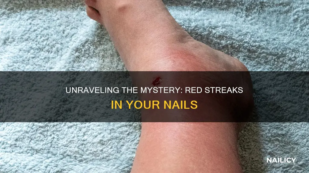 what does red streaks in your nails mean