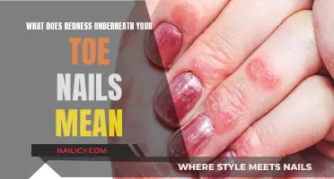 Uncover the Mystery: Redness Beneath Your Toenails