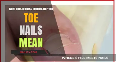Redness Under Your Toenails: What Does It Mean?