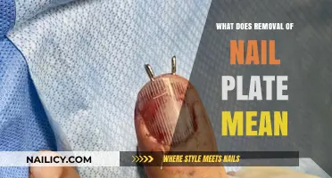 Understanding Nail Plate Removal Procedures