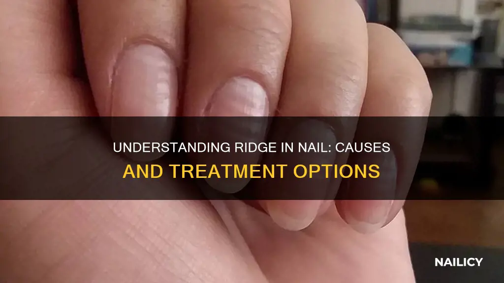 what does ridge in nail mean