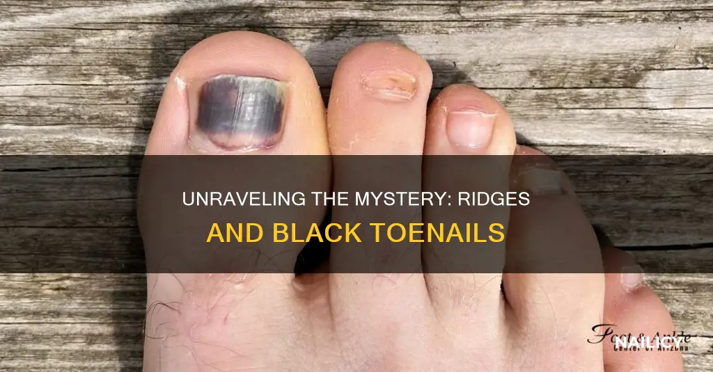 what does ridges and black toe nails mean