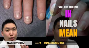 Rigid Lines on Nails: What Do They Mean?