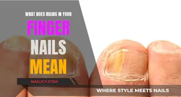 Unraveling the Mystery: What Does 'Rigids' in Your Nails Mean?