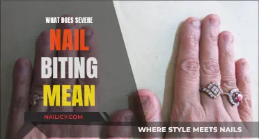 Nail Biting: Understanding the Severity and Underlying Meanings