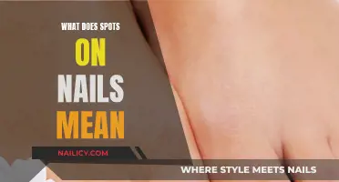 Nail Spots: What Your Nails Are Trying to Tell You