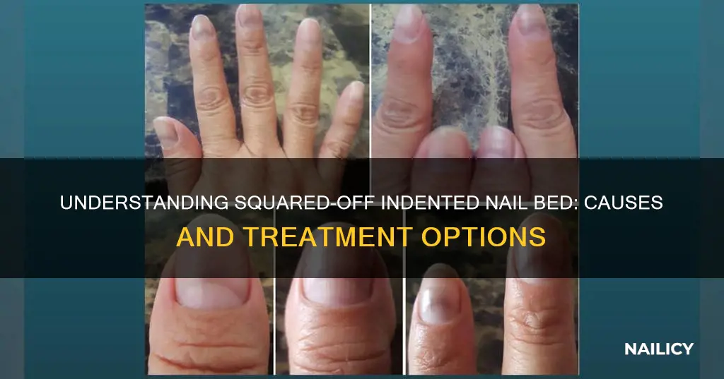 what does squared off indented nail bed mean