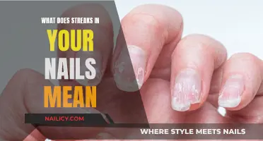 Unraveling the Mystery: What Do Streaks in Nails Indicate?