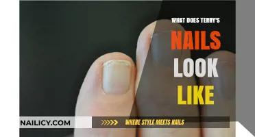 Terry's Nails Appearance: Identifying Characteristics and Visual Guide