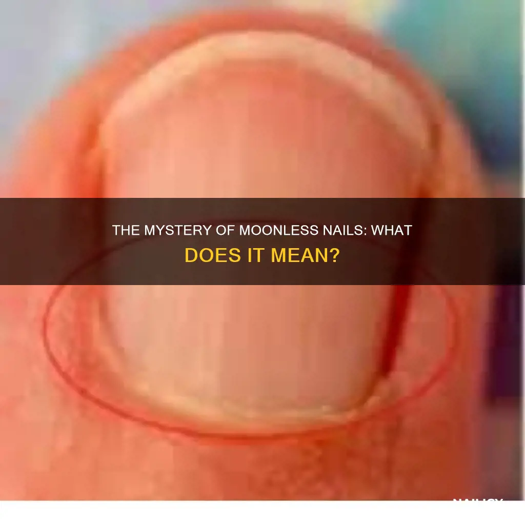what does the absence of moons on nails mean