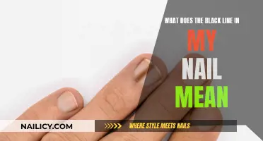 Unraveling the Mystery: What's the Black Line on Your Nail?