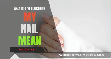 The Black Line on Nails: What Does It Mean?