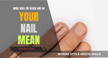 Unraveling the Mystery: Black Line on Your Nail