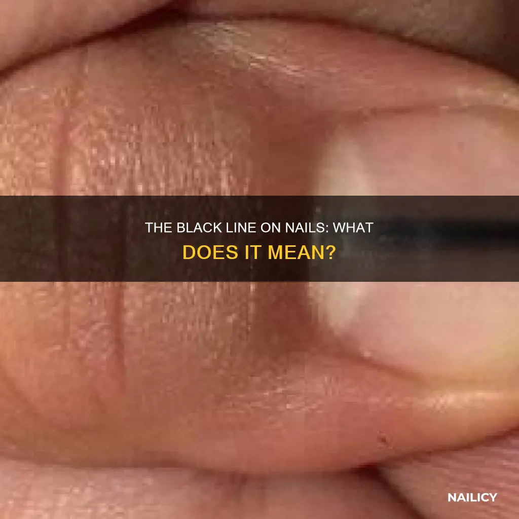 what does the black line on your nail mean