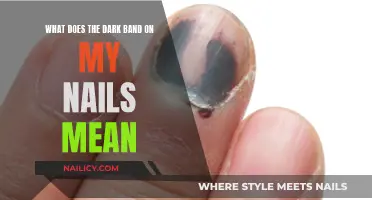 Unraveling the Mystery: Dark Band on Your Nails