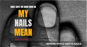The Dark Band on Nails: What Does it Mean?