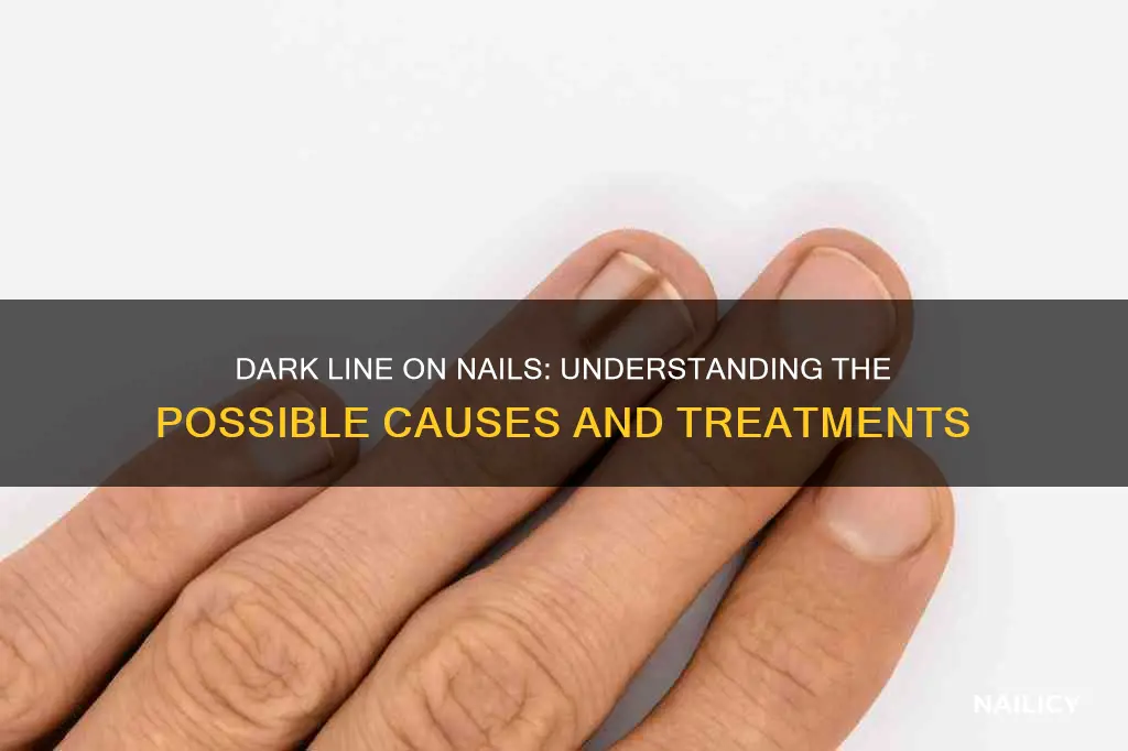 what does the dark line mean in nails