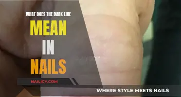 The Dark Line on Nails: What Does it Mean?