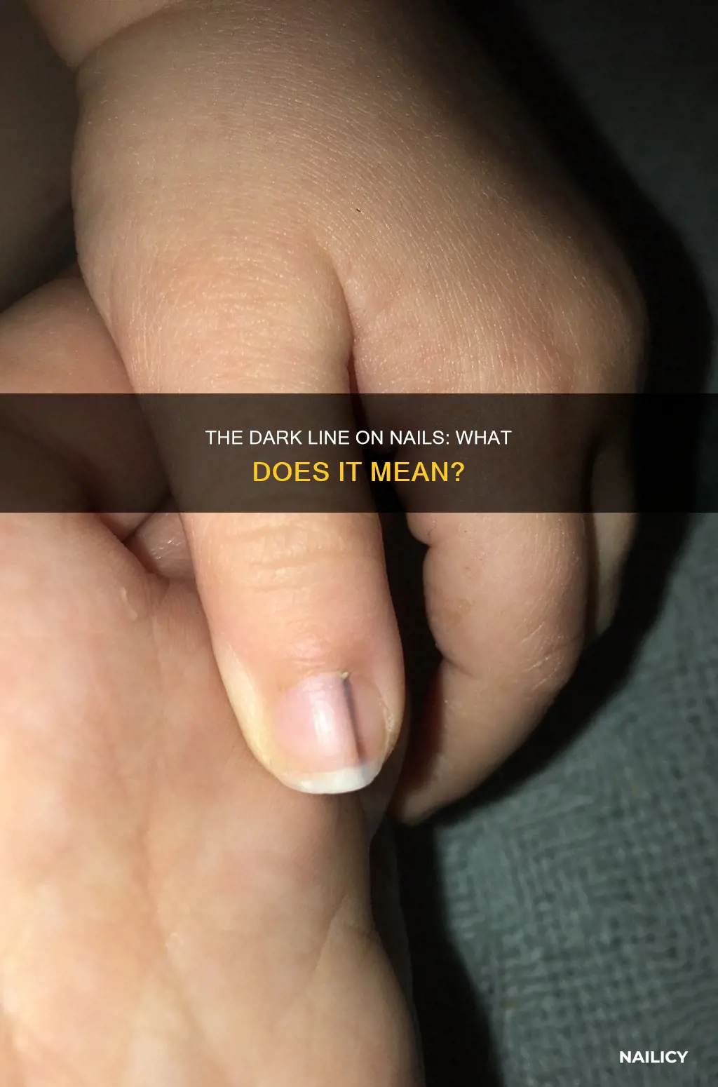 what does the dark line mean in nails