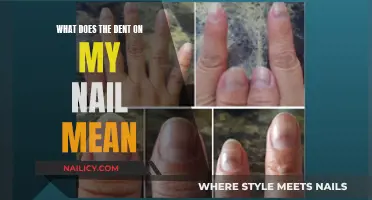 Nail Dents: What Do They Mean?