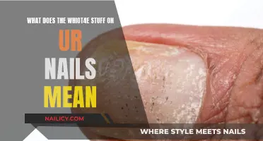 The Mystery of White Spots on Nails: What's the Deal?