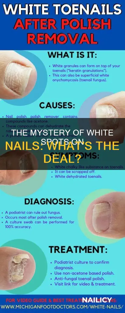 what does the whiot4e stuff on ur nails mean