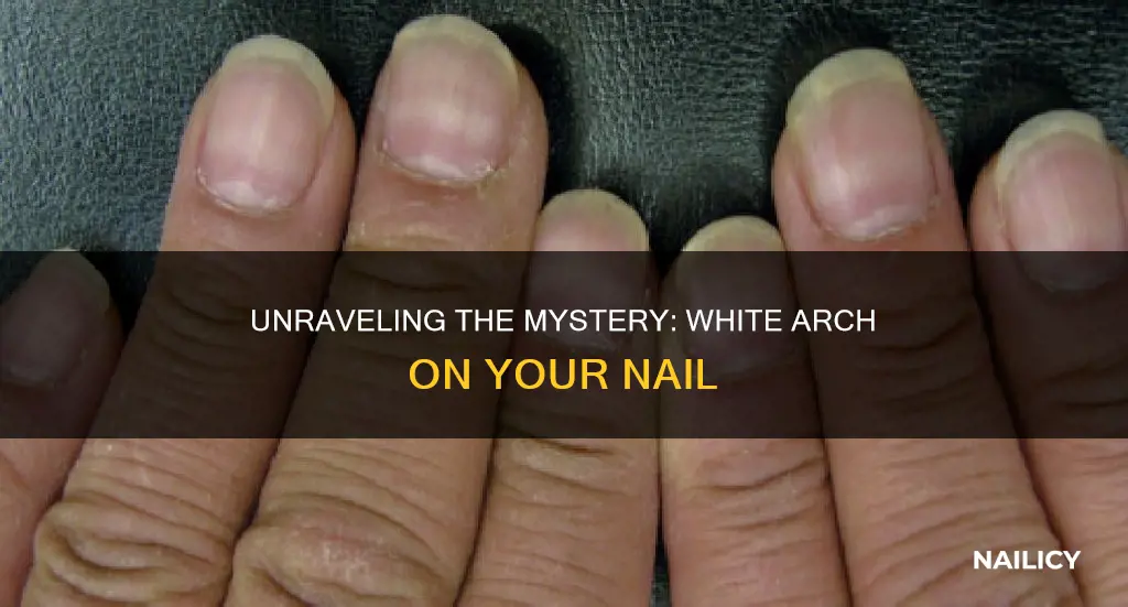 what does the white arch on your nail mean