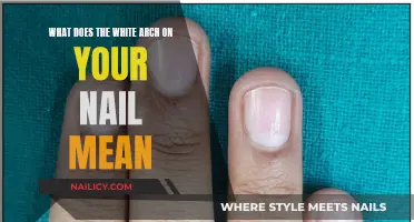 The Mystery of White Arches on Nails: What Do They Mean?