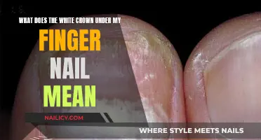 White Crown Under My Finger Nail: Understanding the Cause