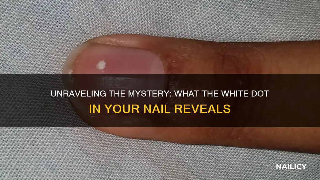 what does the white dot in your nail mean