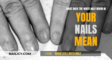 The Mystery of White Half Moons on Nails