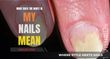 Uncover the Mystery: What Does the White in Your Nails Indicate?