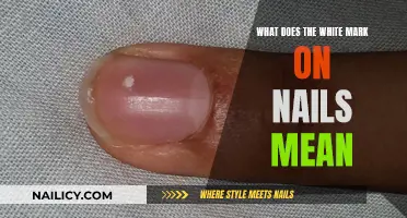 Unraveling the Mystery: White Marks on Nails