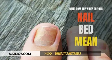 White Spots on Nails: What Do They Mean?
