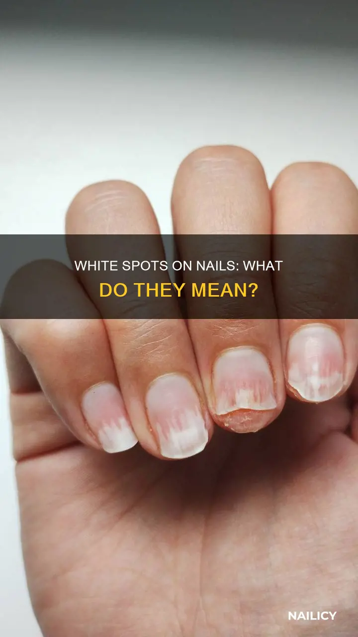 what does the white on your nail bed mean