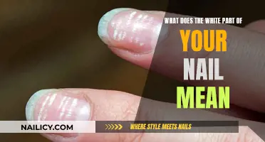 Uncover the Mystery: What Your Nail's White Bits Reveal