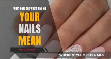The Mystery of White Rings on Nails, Explained