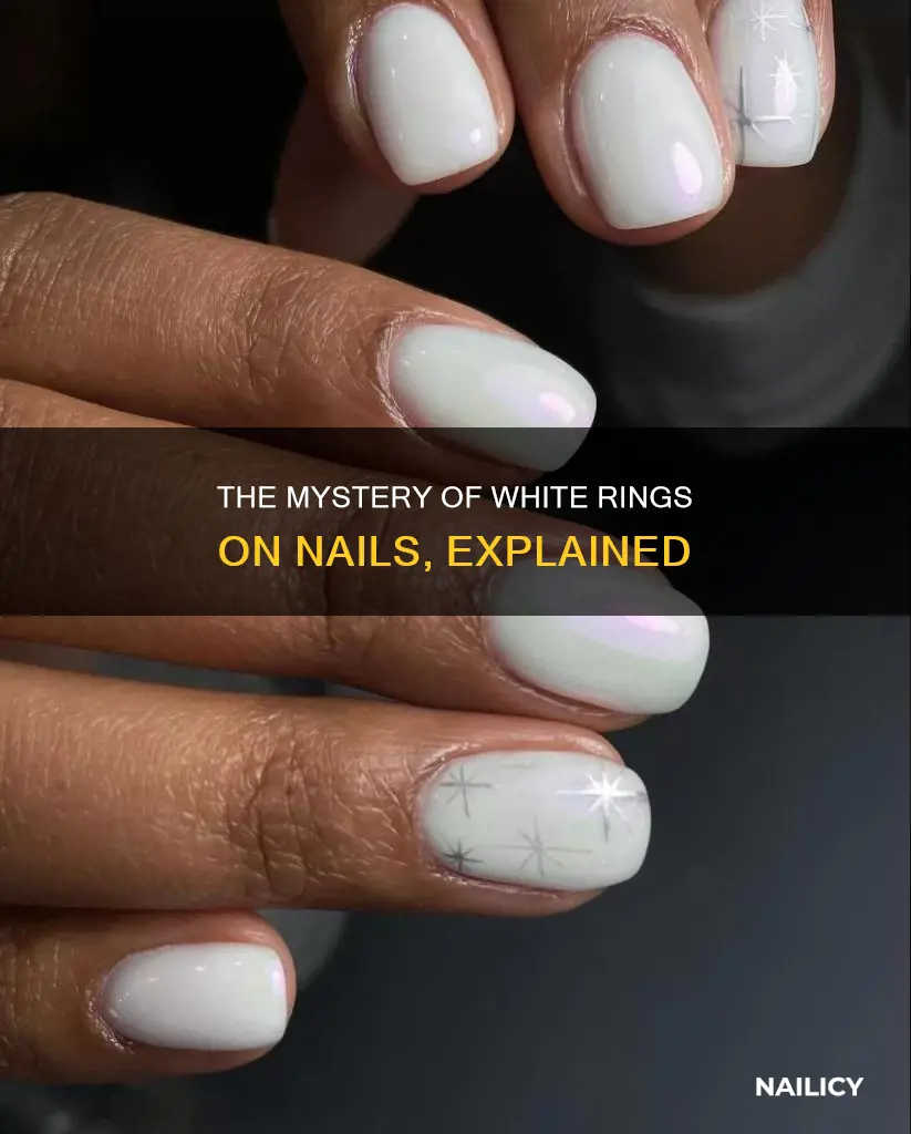 what does the white ring on your nails mean
