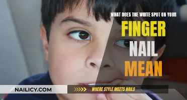 White Spots on Fingernails: What Do They Mean?