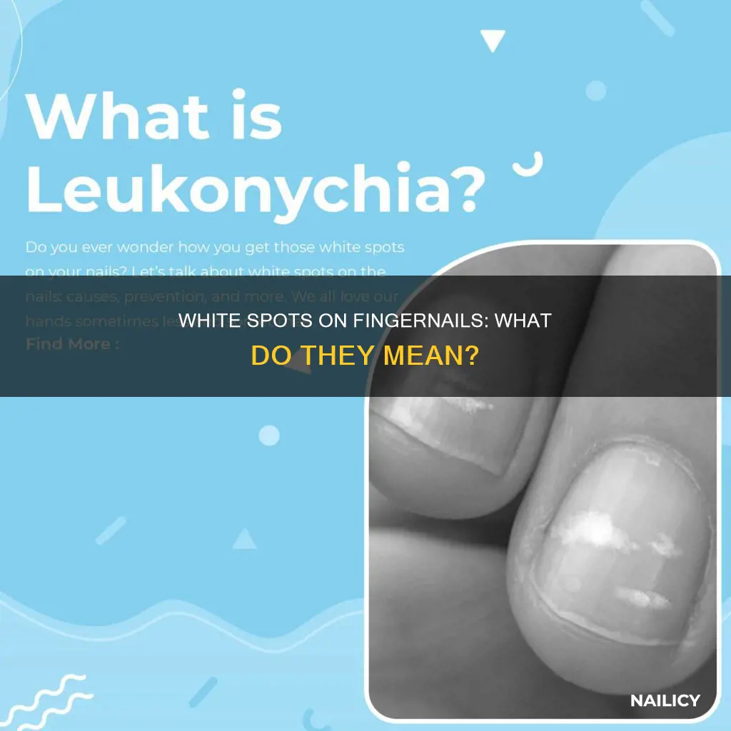 what does the white spot on your finger nail mean