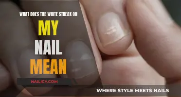 Uncover the Mystery: White Streaks on Your Nails