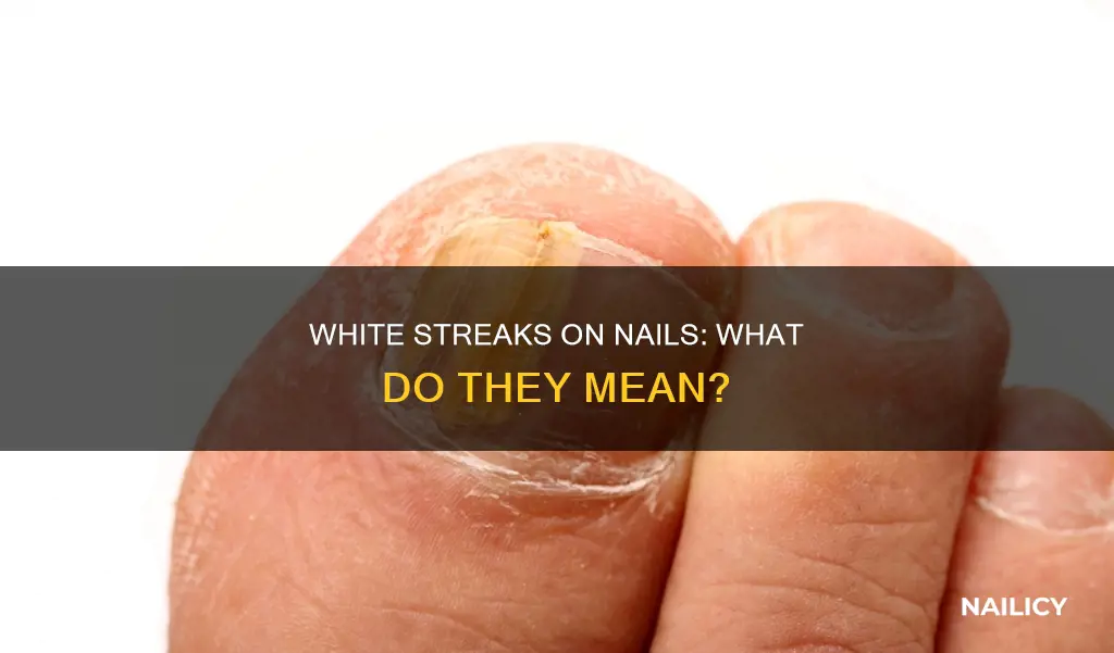 what does the white streak on my nail mean